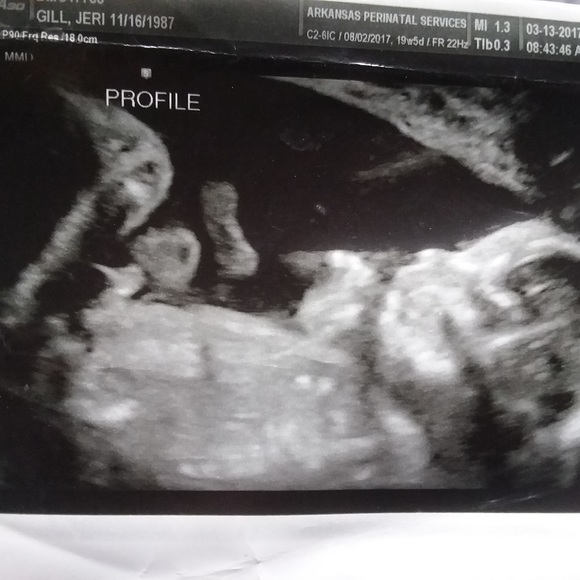 Plz Read Meet the Posher - Involuntarily Childless - Picture 2 of 8